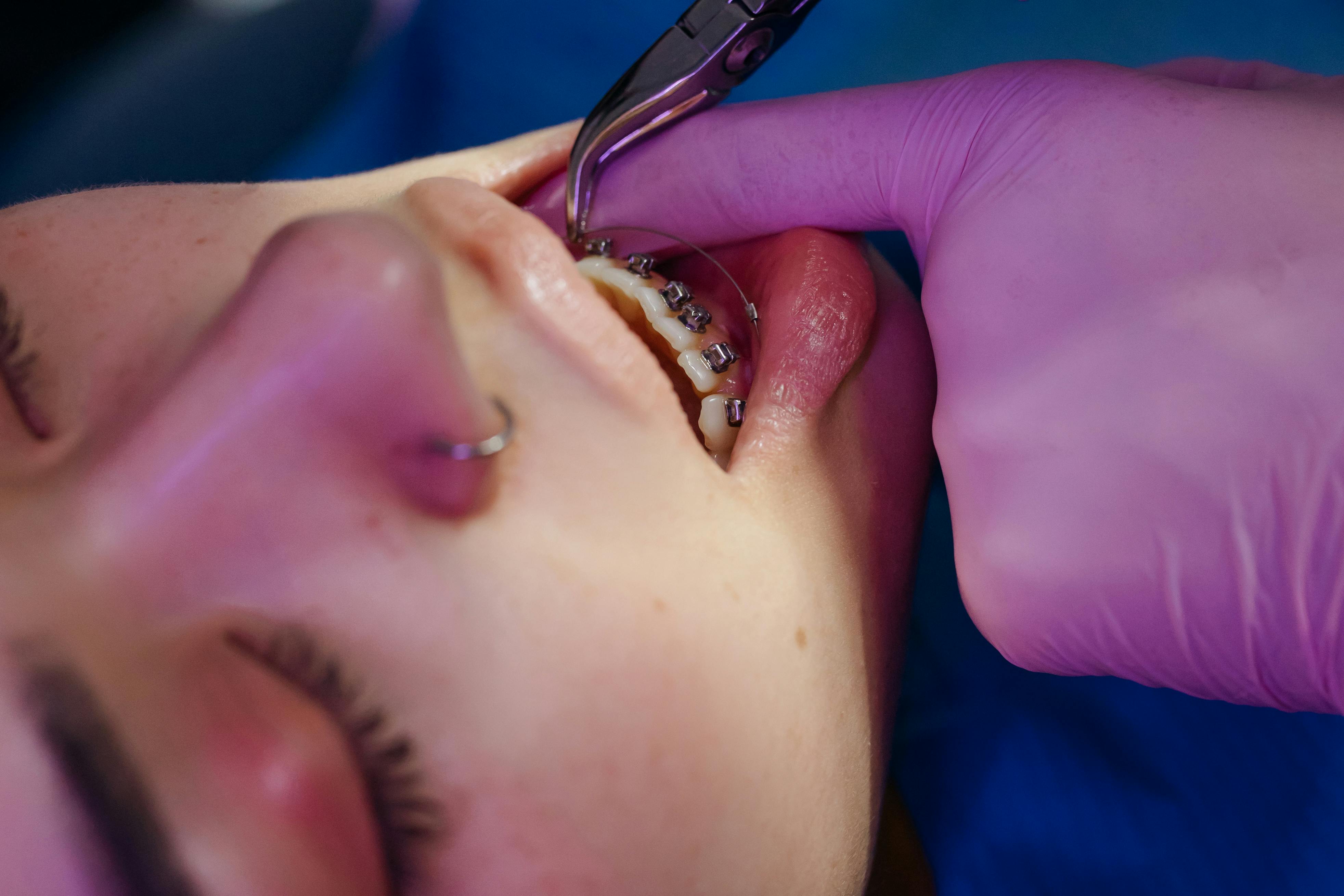 Implant Result