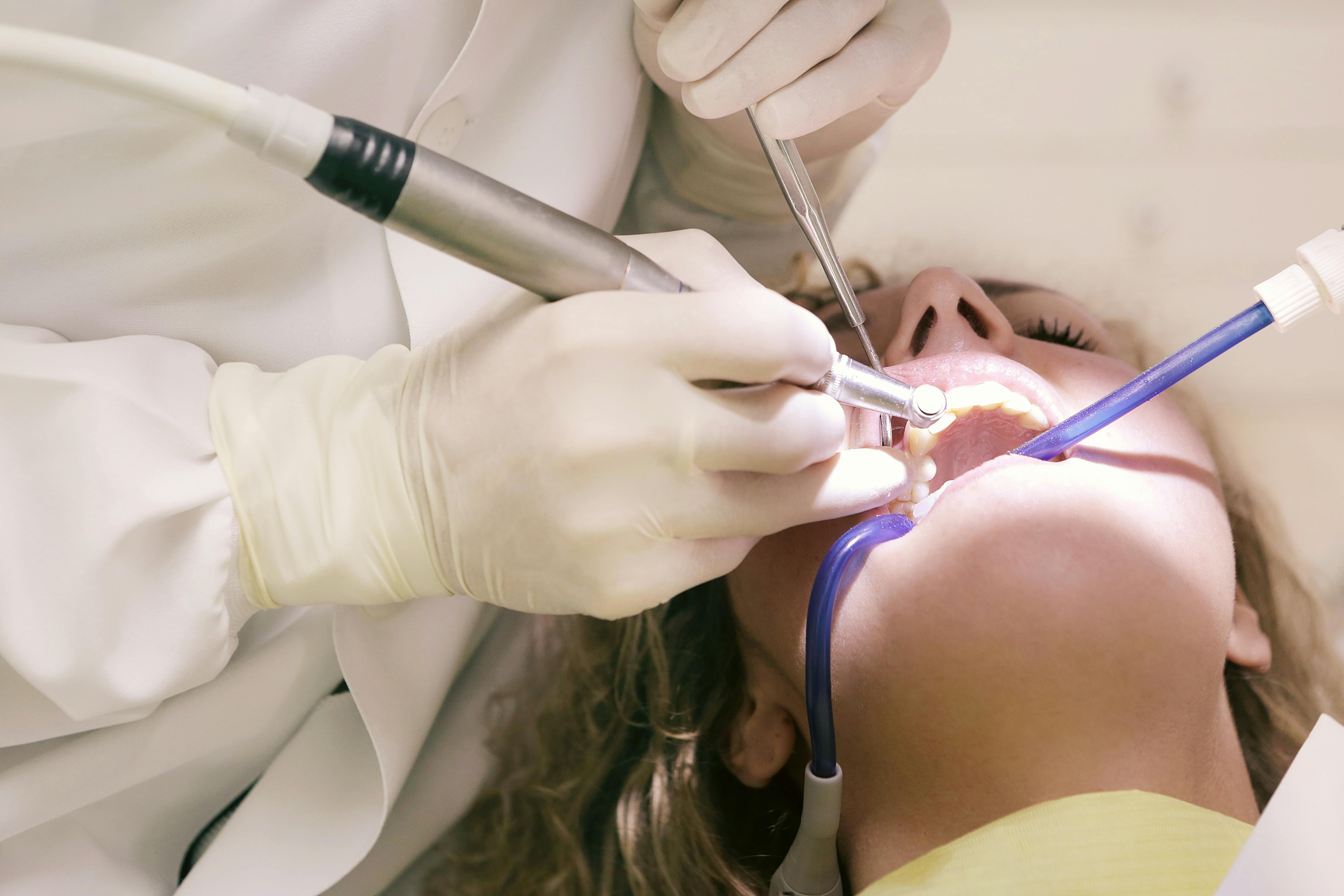 Root Canal